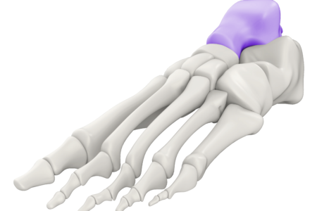Ankle Charcot Ankle Charcot